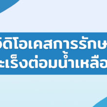 วิดิโอเคสการรักษามะเร็งต่อมน้ำเหลือง