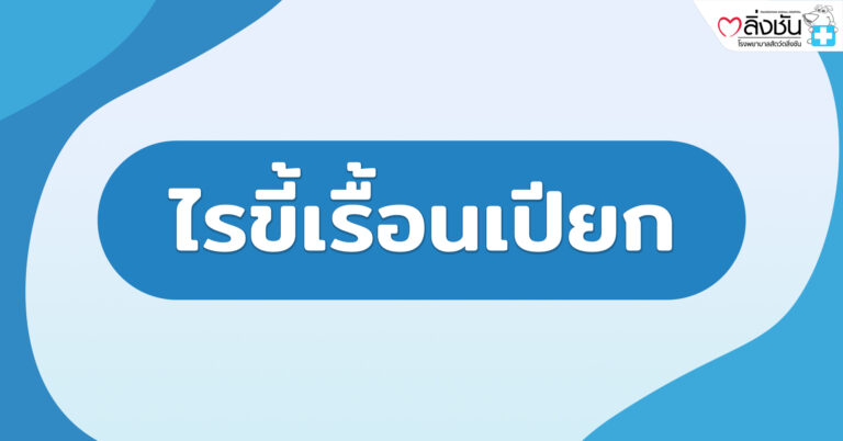 ไรขี้เรื้อนเปียก