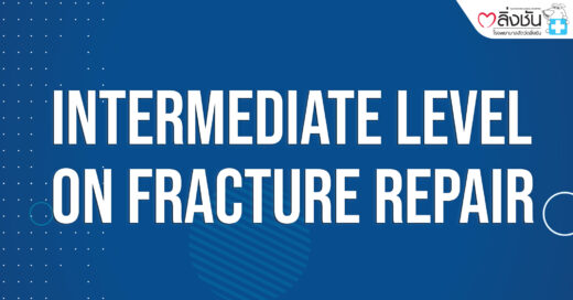 Intermediate Level On Fracture Repair